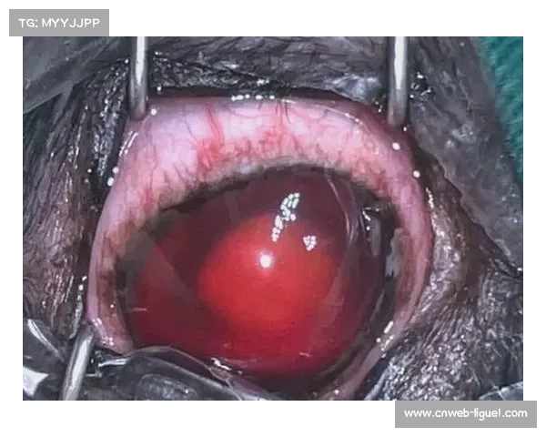 李凯文血战上海赛，右眼严重肿胀仍坚持完赛